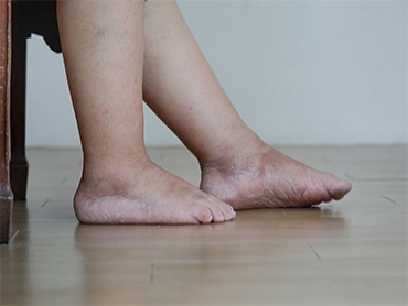 4 Effective Ways to Keep Your Diabetic Feet Healthy