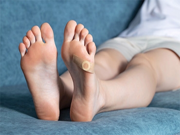 4 Signs You Should Get Your Plantar Warts Removed Right Away