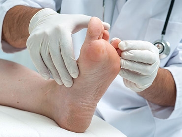 Can a Podiatrist Help with Running? Know the Answer Here
