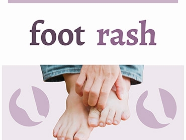 Foot Rash