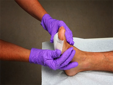Foot Wound Care for People Who are Always on their Feet