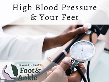 High Blood Pressure & Your Feet
