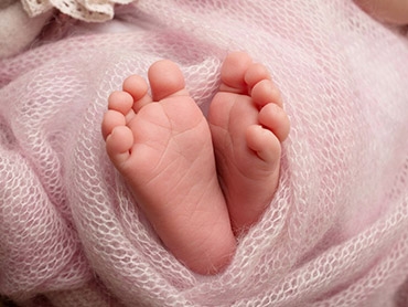 How to Deal with Flat Feet in Infants
