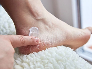 Learn How to Prevent Cracked, Dry Feet