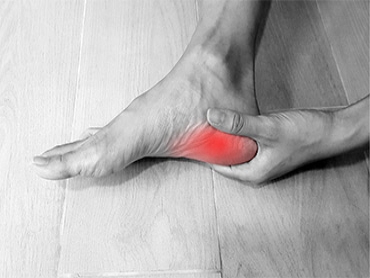 Plantar Fasciitis and Why You Should See a Doctor Right Away