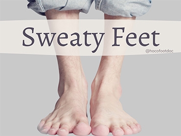 Sweaty Feet