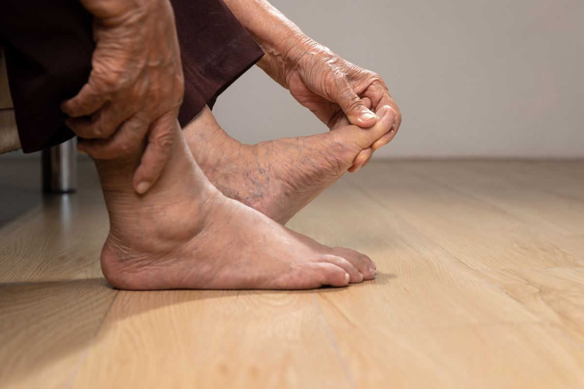 Arthritis Pic