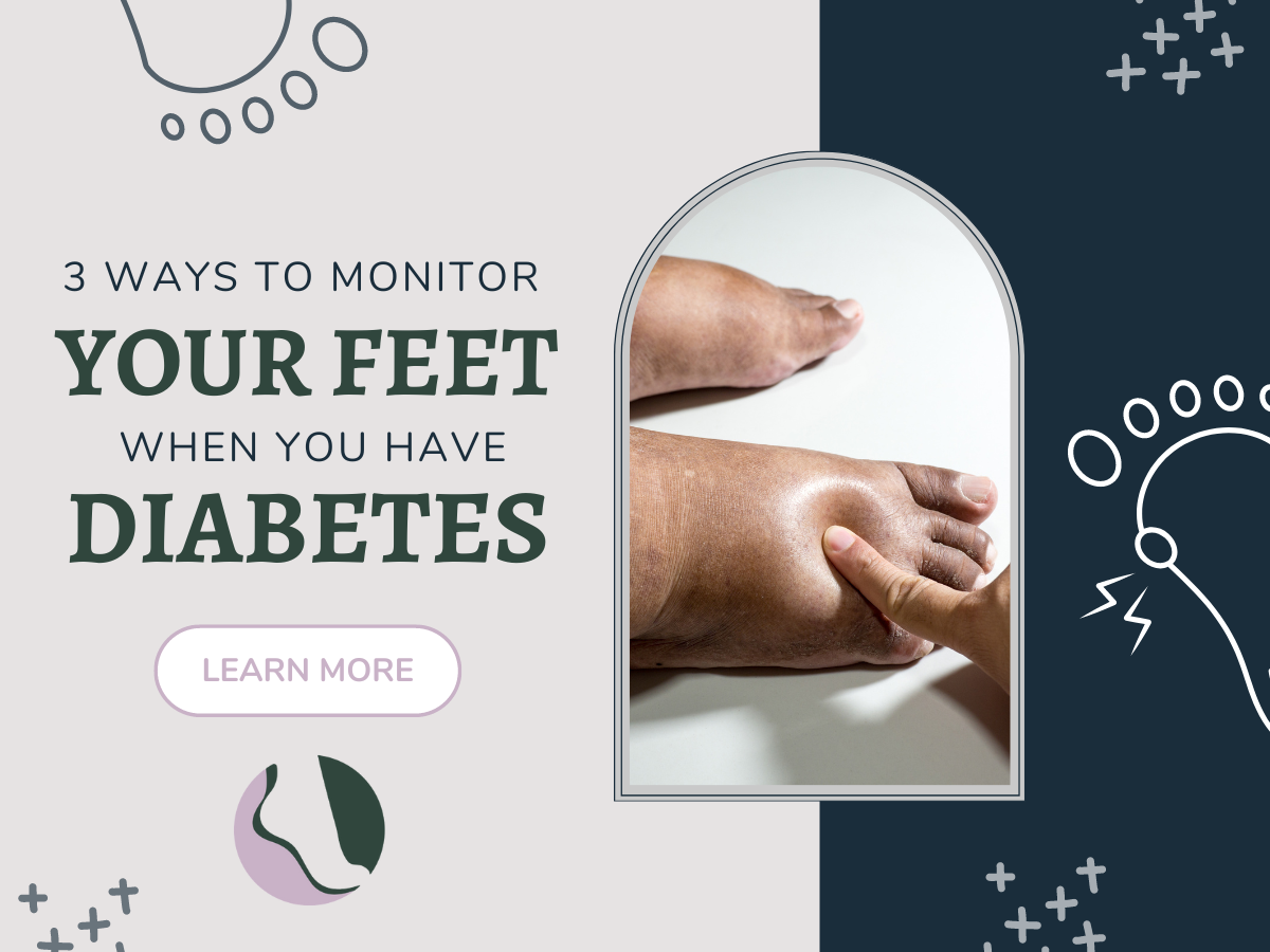 How To Monitor Your Feet Pic