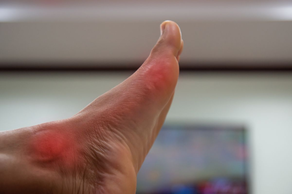 Diagnose Arthritis Pic