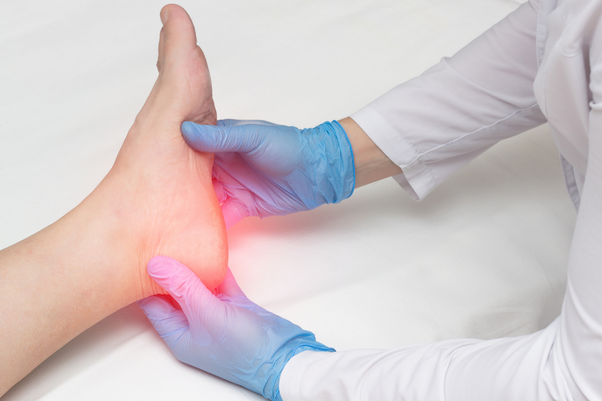 Plantar Fasciitis Pic 2