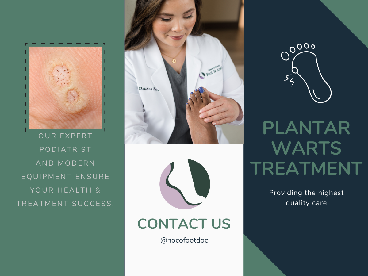 Plantar Warts Pic